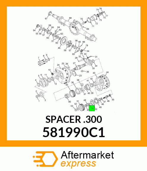 SPACER.300 581990C1