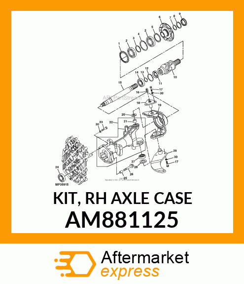 KIT, RH AXLE CASE AM881125